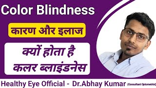 Color Blindness treatment in hindi  कलर ब्लाइंडनेस  color Blindness types and treatment [upl. by Alohcin612]