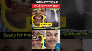 front tooth implant placed with tooth in just 2 days dentalimplants [upl. by Conan721]