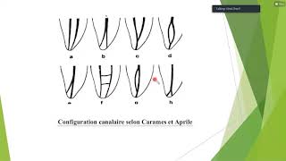 les lesions inflammatoires periapicales dorigine endodontique [upl. by Mercedes]