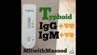 Typhoid igG igM positive  typhoid test positive by ICT method  typhoidtest typhoidfever [upl. by Lusar]