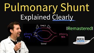 Shunting Explained Clearly Pulmonary Shunt  Remastered [upl. by Poll]