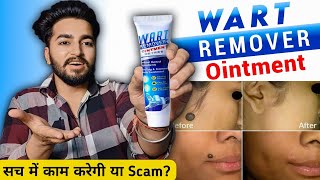 Wart Remover Cream Review  Wart Remover Ointment [upl. by Krefetz]