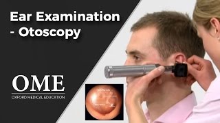 Otoscopy Ear Examination  ENT [upl. by Gnilyarg]