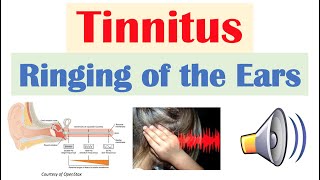 Tinnitus Ringing of the Ears Causes Risk Factors Pathophysiology Symptoms Diagnosis Treatment [upl. by Naitsirk]