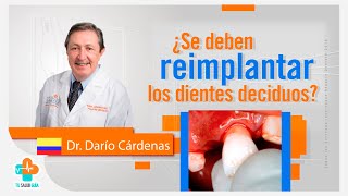 Reimplante de dientes deciduos  Tu Salud Guía [upl. by Nitnert]