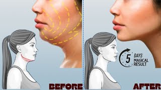 100 EFFECTIVE DOUBLE CHIN FAT amp FACE LIFT  UNIQUE FACIAL EXERCISES [upl. by Erbma]