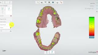 TRIOS 3shape occlusion settings flag adjust for contacts [upl. by Adnoval42]