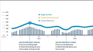 Tips for using SmartGuard Auto Mode – MiniMed™ 770G System [upl. by Anelak]