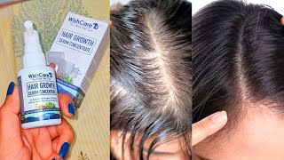 Wishcare Hair Growth Serum Concentrate Results after 3 months  How to apply wishcare hair serum [upl. by Milinda]