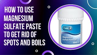 How to treat spots and boils with magnesium sulfate paste [upl. by Muraida2]