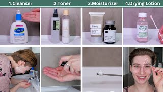 How to use Mario Badescu Drying Lotion in a Skincare Routine [upl. by Alistair]