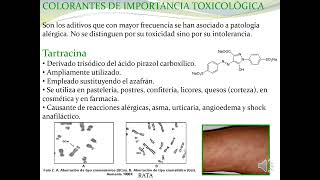 22 2 Toxicología de los alimentos [upl. by Epolenep839]