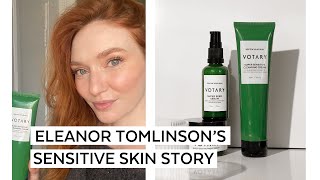 Eleanor Tomlinsons Sensitive Skin Story [upl. by Amando]