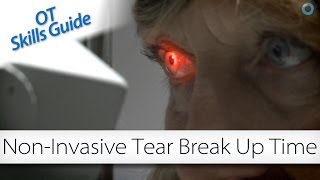 OT skills guide noninvasive tear breakup time [upl. by Airenahs]