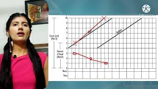 partograph explained [upl. by Valente]