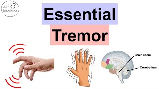 Essential Tremor  Causes Pathophysiology Symptoms Exacerbating Factors Diagnosis Treatment [upl. by Lletniuq266]