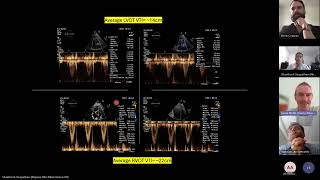 Cases for post MI complication talk [upl. by Nytsyrk]