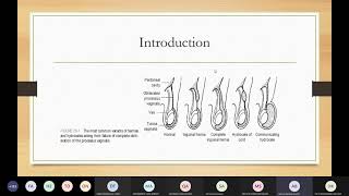 Pediatric Inguinoscrotal Disorders  Dr Ahmad Barakat [upl. by Naasar]