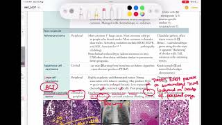 Bronchial Carcinoid tumor Respiratory 56  First Aid USMLE Step 1 in UrduHindi [upl. by Robaina]