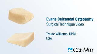 Dr Trevor Williams  Evans Calcaneal Osteotomy  CONMED Surgical Technique [upl. by Nednal872]