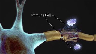 What is Multiple Sclerosis [upl. by Qifar]