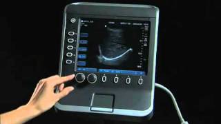 Sonosite S Series Product Training Part 2 Screen Layout [upl. by Madeline936]