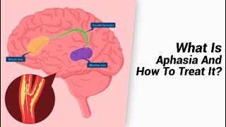 What Is Aphasia And How To Treat It [upl. by Lebasiram]