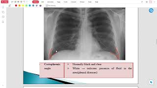 Radiology Lec 2 [upl. by Yecart135]