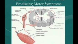 Clinical Significance of Demyelinating Lesions of the Central Nervous System [upl. by Simson]