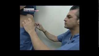 Lipolyse de labdomen par le Docteur Thierry LAFITTE TV5 Mondemp4 [upl. by Cardon]