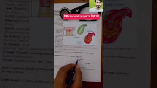 ultrasound report kaise dekhe  hepatomegaly with fatty liver  hepatomegaly [upl. by Fontana]