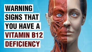 10 Symptoms of Vitamin B12 Deficiency You Should Never Ignore [upl. by Eirrej804]