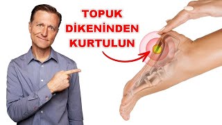 Topuk Dikeninden Kurtulun Artık Topuk Ağrınız Olmayacak [upl. by Mcquoid]