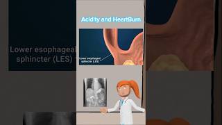 Acidity and HeartBurn youtubeshorts viralvideo fitness motivation ai cartoon animation neet [upl. by Faust]