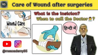 Care of Wound I Care of Surgical Wound I Wound Care  Wound Healing  How To Heal Wounds Faster [upl. by Francyne672]