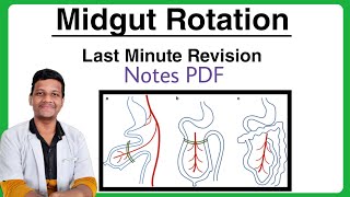 Midgut Rotation  Embryology  Anatomy  1st Year MBBS University Exam  Sudharshan R [upl. by Carolle]