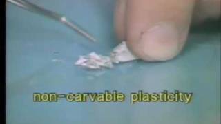 Introduction to Amalgam  Capmaster Tytin [upl. by Sholem]