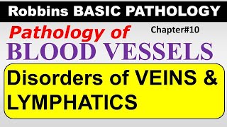 Ch10  Disorders of Veins amp Lymphatics  Blood Vessel Pathology  Robbins Lectures [upl. by Rozanna]