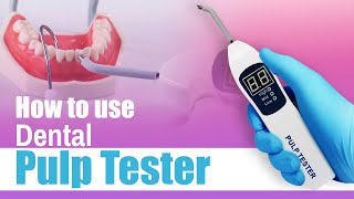 How to use Dental Pulp Tester  Waldent Pulp Tester [upl. by Schramke263]