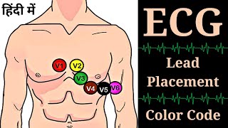 ECG in Hindi  12 ECG Lead Placement  ECG Lead Color Code  ECG Lead Position  Nursing  GNM [upl. by Sabanrab212]