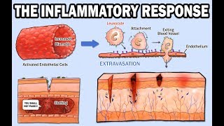 THE INFLAMMATORY RESPONSE [upl. by Aurelea876]