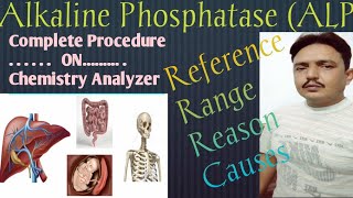 Alkaline Phosphatase ALP Urdu amp Hindi with procedure December 16 2020 [upl. by Ubald]