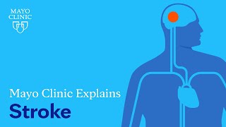 Mayo Clinic Explains Strokes [upl. by Trici656]