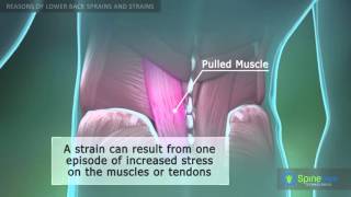 Lower Back Sprain and Strain Reasons [upl. by Ffej81]