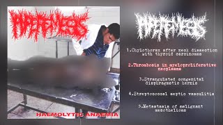 Hyperemesis  Haemolytic Anaemia Split with PxCxSx 2013 Goregrind [upl. by Ynamad]