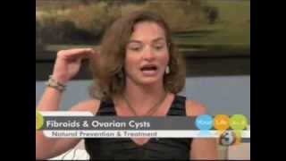 Dr Theresa Ramsey  Fibroids amp Ovarian Cysts [upl. by Doner]