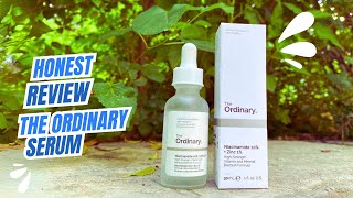 Honest review on the ordinary niacinamide 10 and zinc 1 serum  ordinary serum review [upl. by Adora]