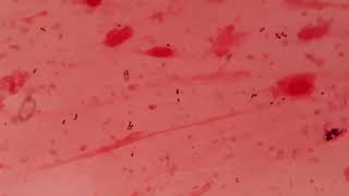 Gram positive cocci in sputum specimen I Gram stain [upl. by Cochrane]