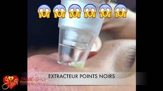 EXTRACTEUR POINTS NOIRS [upl. by Eentrok]