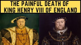 The PAINFUL Death Of King Henry VIII Of England [upl. by Siusan]